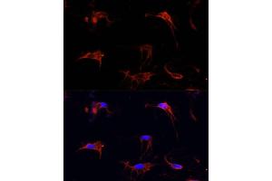 Immunofluorescence analysis of C6 cells using FBN1 Polyclonal Antibody (ABIN7267176) at dilution of 1:100 (40x lens). (Fibrillin 1 抗体  (AA 360-460))