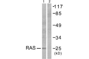 Western blot analysis of extracts from HeLa cells, using RASH/RASK/RASN antibody (ABIN5976497). (RASH/RASK/RASN (N-Term) 抗体)