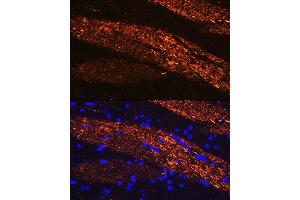 Immunofluorescence (IF) image for anti-Neurofilament, Light Polypeptide (NEFL) (AA 400-543) antibody (ABIN3020809)