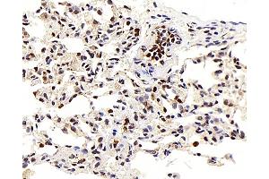 Immunohistochemistry analysis of paraffin-embedded Rat lung using LEP Polyclonal Antibody at dilution of 1:100. (Leptin 抗体)