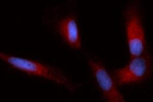 Immunofluorescence (IF) image for anti-Immunoglobulin Binding Protein (BIP) (AA 20-650) antibody (PE) (ABIN5566443) (BIP 抗体  (AA 20-650) (PE))