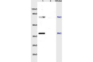 Lane 1: rat brain lysates Lane 2: rat kidney lysates probed with Anti ZNF185 Polyclonal Antibody, Unconjugated (ABIN762716) at 1:200 in 4 °C. (Zinc Finger Protein 185 抗体  (AA 551-650))