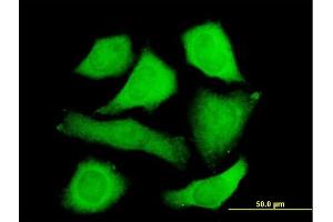 Immunofluorescence of purified MaxPab antibody to STIP1 on HeLa cell. (STIP1 抗体  (AA 1-543))