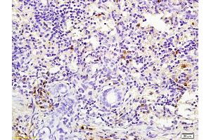 Formalin-fixed and paraffin embedded mouse lung labeled with Rabbit Anti pro-caspase-3 Polyclonal Antibody, Unconjugated (ABIN747728) at 1:200 followed by conjugation to the secondary antibody and DAB staining (Caspase 3 抗体  (AA 11-120))