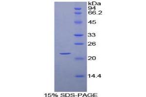 SDS-PAGE analysis of Chicken Cyclophilin B Protein.