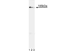 Western blot analysis of human DCC protein in 293 human embryonic kidney cells stably transfected with an expression vector containing full length DCC cDNA. (DCC 抗体)