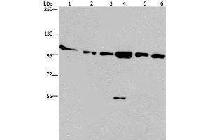 Western Blot analysis of Human testis tissue, K562, A549, Raji, NIH/3T3 and Hela cell using PRKD3 Polyclonal Antibody at dilution of 1:200 (PRKD3 抗体)
