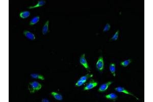 Immunofluorescent analysis of Hela cells using ABIN7164554 at dilution of 1:100 and Alexa Fluor 488-congugated AffiniPure Goat Anti-Rabbit IgG(H+L) (SLC31A2 抗体  (AA 44-93))