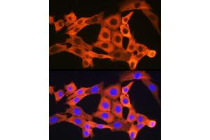 Immunofluorescence analysis of NIH-3T3 cells using JNK1/JNK3 Rabbit mAb (ABIN1678909, ABIN7101754, ABIN7101755 and ABIN7101756) at dilution of 1:100 (40x lens). (JNK 抗体)