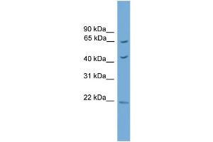 WB Suggested Anti-Tbx18 Antibody Titration:  0. (T-Box 18 抗体  (Middle Region))