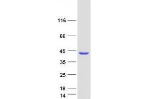 Western Blotting (WB) image for Clathrin, Light Chain B (CLTB) (Transcript Variant 2) protein (Myc-DYKDDDDK Tag) (ABIN2712848)