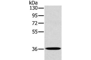 Western Blot analysis of A172 cell using CLP36 Polyclonal Antibody at dilution of 1:400 (PDLIM1 抗体)