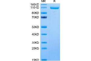 Human ENPP-3 on Tris-Bis PAGE under reduced condition. (ENPP3 Protein (AA 48-875) (His-Avi Tag))