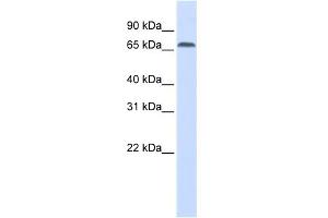 WB Suggested Anti-IRF2BP1 Antibody Titration: 0. (IRF2BP1 抗体  (Middle Region))