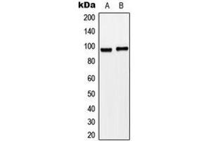 Western blot analysis of Matriptase expression in HeLa (A), SW620 (B) whole cell lysates. (ST14 抗体  (N-Term))