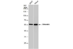 WB Image Vimentin antibody detects Vimentin protein by western blot analysis. (Vimentin 抗体)