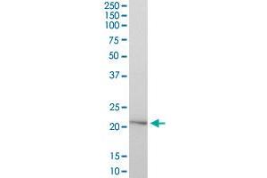 HYAL1 MaxPab polyclonal antibody. (HYAL1 抗体  (AA 1-253))