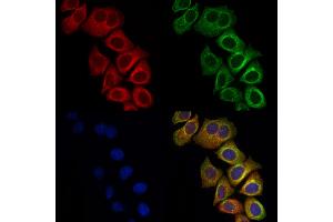 ABIN6261515 and ABIN6278456 staining Hela cells by IF/ICC. (ELMO1 抗体  (C-Term))