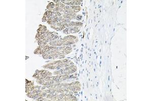 Immunohistochemistry (IHC) image for anti-ATPase, Na+/K+ Transporting, beta 1 Polypeptide (ATP1B1) (AA 63-303) antibody (ABIN6137306)