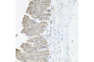 Immunohistochemistry of paraffin-embedded mouse stomach using B1 antibody (ABIN6127389, ABIN6137306, ABIN6137309 and ABIN6221475) at dilution of 1:100 (40x lens). (ATP1B1 抗体  (AA 63-303))