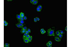 Immunofluorescent analysis of HepG2 cells using ABIN7173980 at dilution of 1:100 and Alexa Fluor 488-congugated AffiniPure Goat Anti-Rabbit IgG(H+L)