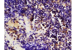 Formalin-fixed and paraffin embedded mouse spleen labeled with Anti-phospho-MAP4K1(Ser171)Polyclonal Antibody, Unconjugated  at 1:200 followed by conjugation to the secondary antibody and DAB staining (MAP4K1 抗体  (pSer171))