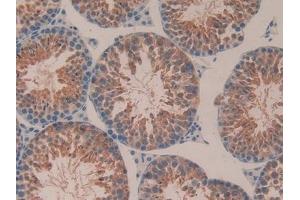 Detection of ITGaV in Mouse Testis Tissue using Polyclonal Antibody to Integrin Alpha V (ITGaV) (CD51 抗体  (AA 71-322))