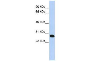 WB Suggested Anti-FAM119A Antibody Titration: 0. (FAM119A 抗体  (N-Term))