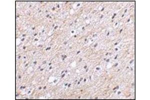 Immunohistochemical staining of human brain tissue using AP30597PU-N at 2. (NIPSNAP1 抗体  (Center))