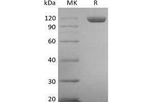 TEK Tyrosine Kinase, Endothelial (TEK) protein (His tag)