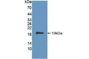 Western blot analysis of recombinant Mouse CA7. (CA7 抗体  (AA 58-217))