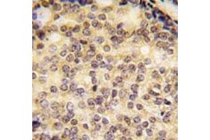 Immunohistochemistry (IHC) image for anti-SRY (Sex Determining Region Y)-Box 9 (SOX9) (AA 41-70) antibody (ABIN3032745)