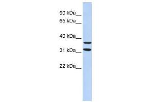 ZNF254 antibody used at 1. (ZNF254 抗体  (Middle Region))