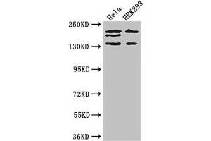 Western Blot Positive WB detected in: Hela whole cell lysate, HEK293 whole cell lysate All lanes: ITSN2 antibody at 4 μg/mL Secondary Goat polyclonal to rabbit IgG at 1/50000 dilution Predicted band size: 194, 191, 142, 136 kDa Observed band size: 194, 191, 142 kDa (Intersectin 2 抗体  (AA 940-1209))