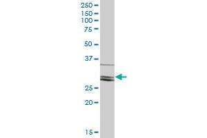 CLIC2 MaxPab polyclonal antibody. (CLIC2 抗体  (AA 1-247))