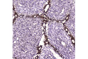 IHC analysis of Glutathione Reductase using anti-Glutathione Reductase antibody . (Glutathione Reductase 抗体  (AA 256-522))