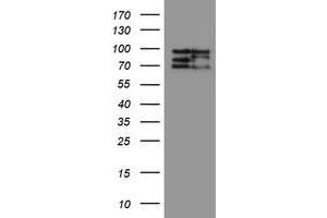 Image no. 10 for anti-CCR4-NOT Transcription Complex Subunit 4 (CNOT4) (AA 190-455) antibody (ABIN1491098)