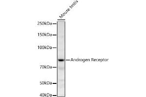 Western blot analysis of extracts of Mouse testis, using Androgen Receptor antibody (ABIN3022797, ABIN3022798, ABIN3022799 and ABIN6219233) at 1:668 dilution. (Androgen Receptor 抗体)