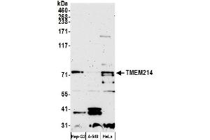 anti-Transmembrane Protein 214 (TMEM214) (AA 1-50) antibody