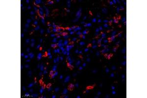 Immunofluorescence of paraffin embedded human kidney using KCTD19 (ABIN7075147) at dilution of 1: 500 (450x lens) (KCTD19 抗体)