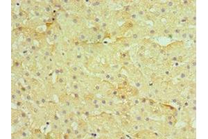 Immunohistochemistry of paraffin-embedded human liver tissue using ABIN7155385 at dilution of 1:100 (H2AFZ 抗体  (AA 1-128))