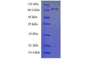 SDS-PAGE (SDS) image for Estrogen Receptor 1 (ESR1) (AA 10-595) protein (His tag) (ABIN7478954)