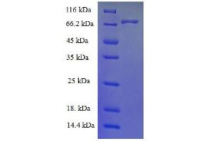 Protein expressed in E. (Estrogen Receptor alpha Protein (AA 10-595) (His tag))
