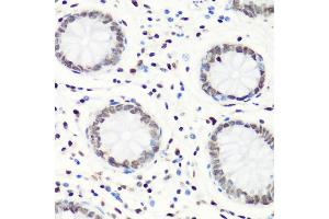 Immunohistochemistry of paraffin-embedded human colon using MonoMethyl-Histone H4-R3 antibody (ABIN1680263, ABIN1680264, ABIN6220110 and ABIN6220114) at dilution of 1:100 (40x lens). (Histone H4 抗体  (meArg3))