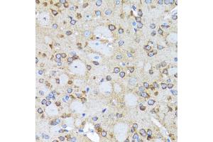 Immunohistochemistry of paraffin-embedded rat brain using ACTR2 antibody (ABIN2560930) at dilution of 1:100 (40x lens). (ACTR2 抗体)