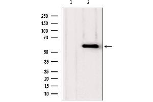 Western blot analysis of extracts from various samples, using PHGDH antibody. (PHGDH 抗体  (N-Term))