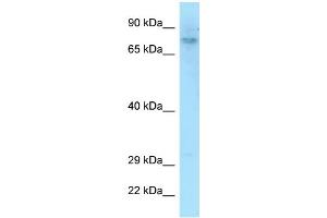 WB Suggested Anti-DEF6 Antibody Titration: 1. (DEF6 抗体  (C-Term))