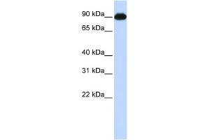 WB Suggested Anti-CTAGE5 Antibody Titration:  0. (MIA2 抗体  (Middle Region))