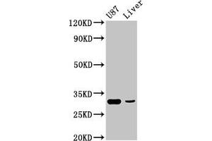 Western Blot Positive WB detected in: U87 whole cell lysate, Rat liver tissue All lanes: ITM2B antibody at 4. (RHCG 抗体  (AA 416-479))