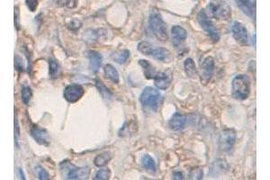 Immunohistochemical staining of formalin-fixed paraffin-embedded human skin tissue with ADAMTS2 polyclonal antibody  at 1 : 200 dilution. (Adamts2 抗体  (C-Term))